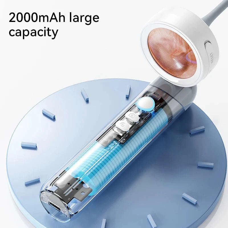 1080P Otoscope Ear Camera with Screen and LED Lights for Clear Inspection-WHITE / United States