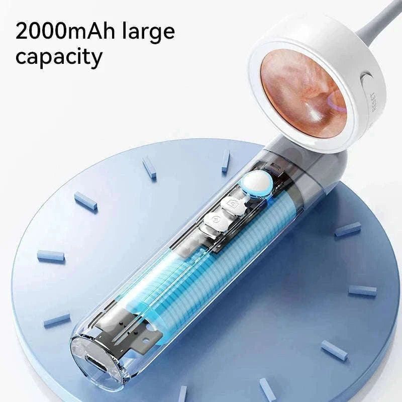 1080P Otoscope Ear Camera with Screen and LED Lights for Clear Inspection-WHITE / United States