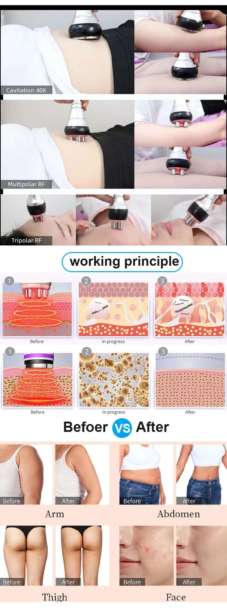 3-in-1 Beauty Body Slimming Massager Cavitation Machine-3 in 1 / spain