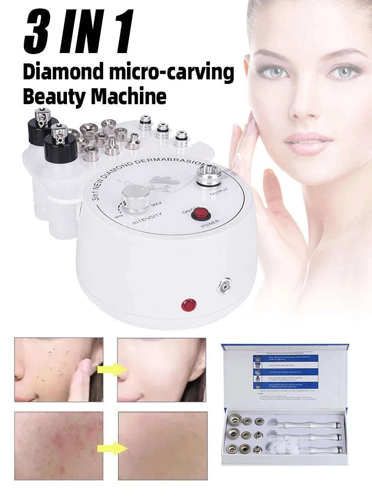 3-in-1 Facial Peeling Deep Cleansing Device-3 in 1 White / US / United States