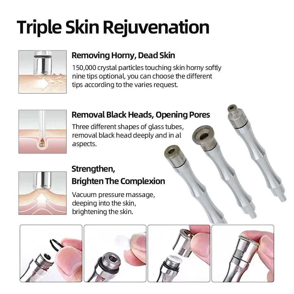 3-in-1 Facial Peeling Deep Cleansing Device-3 in 1 White / US / United States
