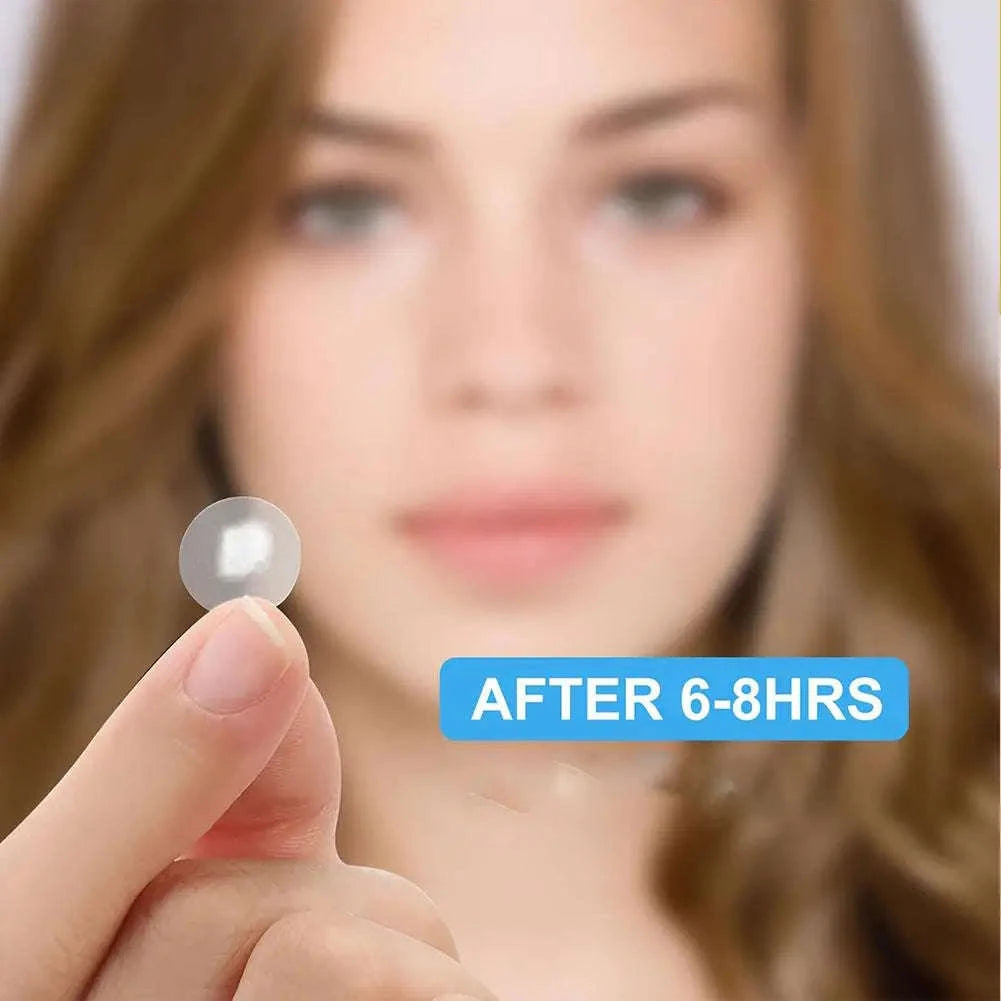 360pcs Colorful Acne Patch Set-A / CN