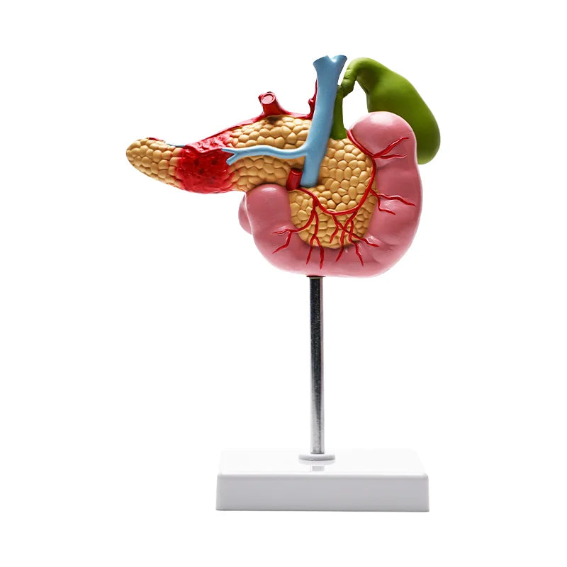 Gallbladder, Pancreas and Duodenum Pathology Teaching Model