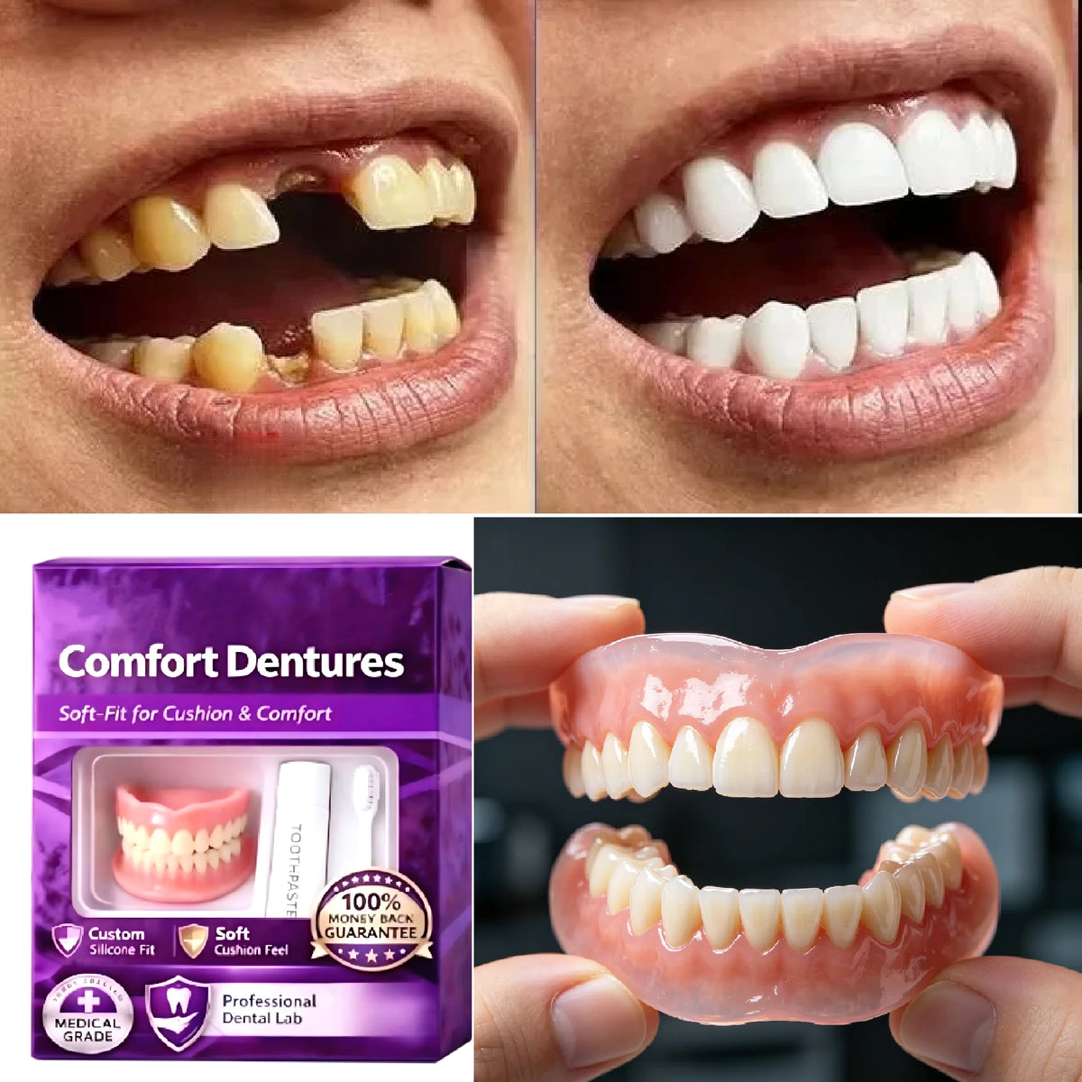 Conjunto de capas cosméticas dentárias temporárias em silicone