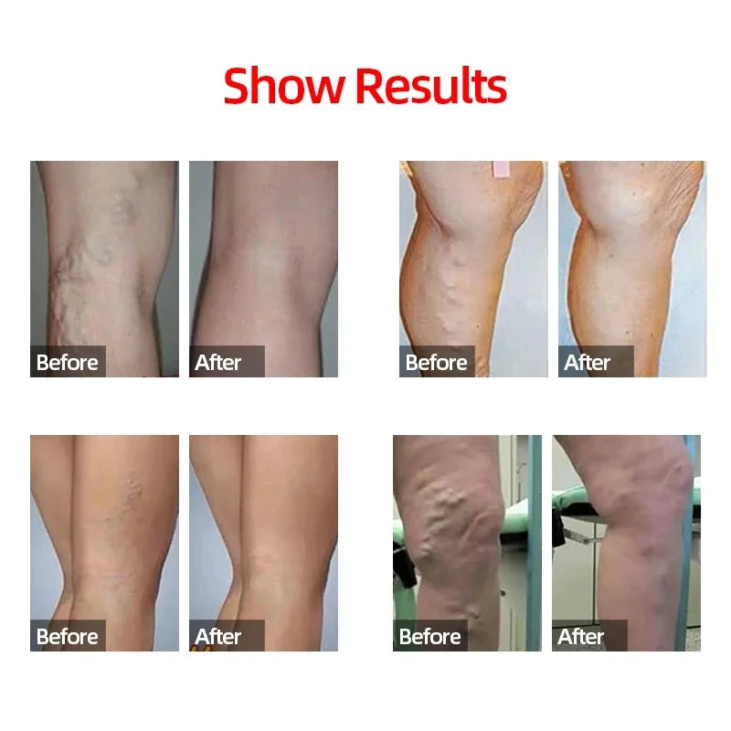 1 Pair Compression Calf Sleeves Running Leg Compression Sleeve Compression Socks for Shin Splint For Men Women 20-30mmHg