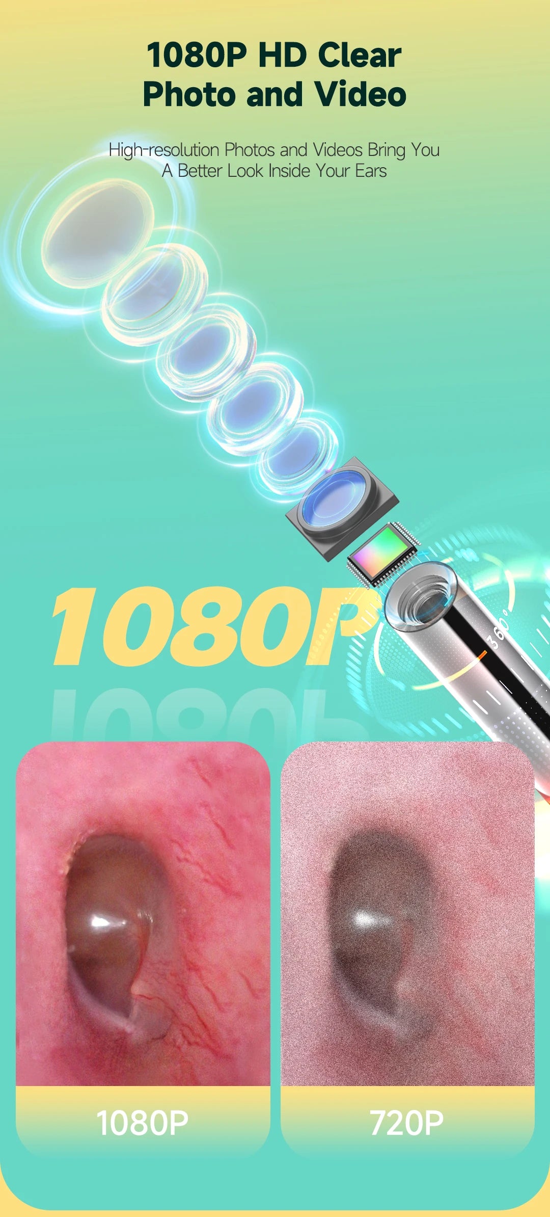 Wireless Otoscope - Camera and Accessory Options