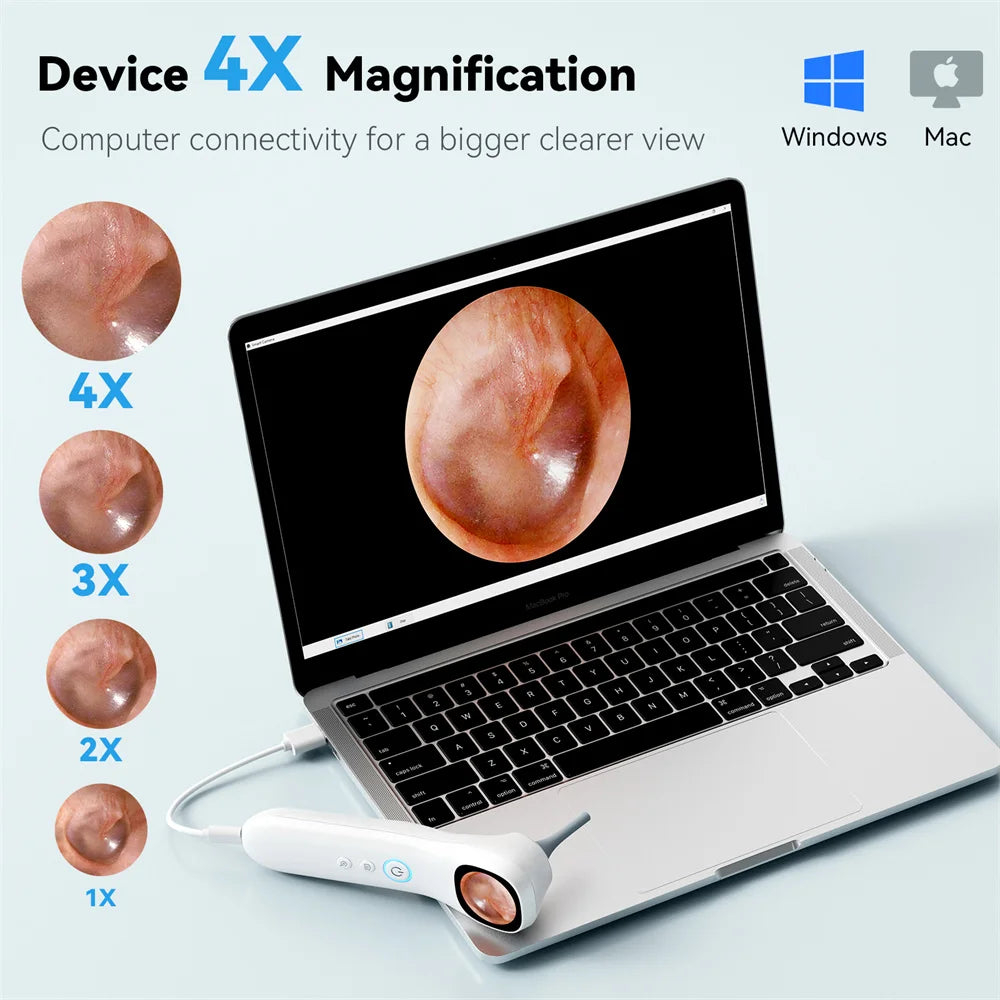 5-in-1 Ear Camera with Screen and Ear Pick Set