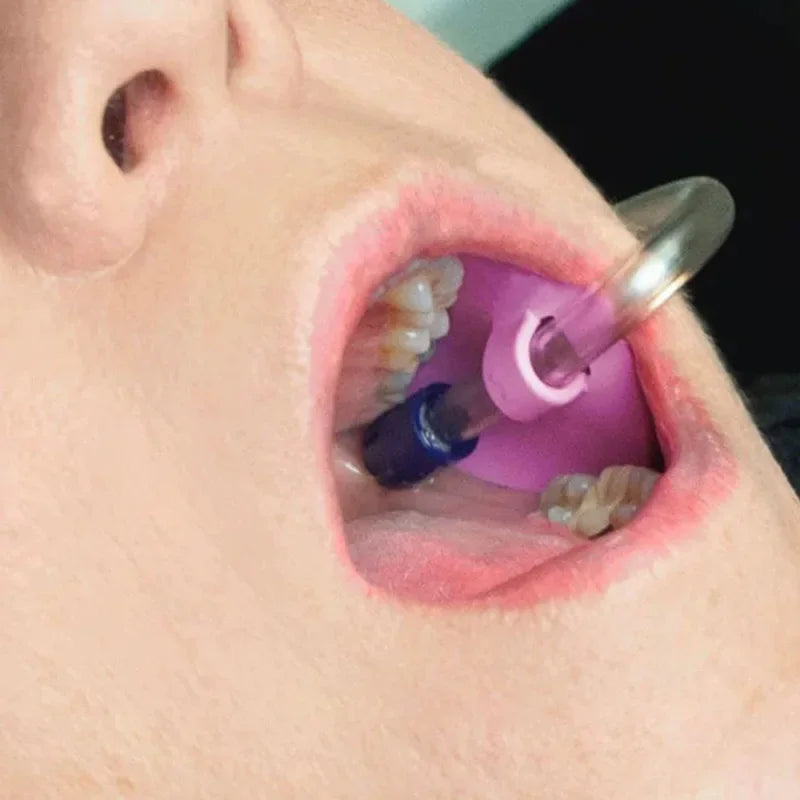 Autoclavable Dental Suction Tube Holder for HVE, 10 Pack