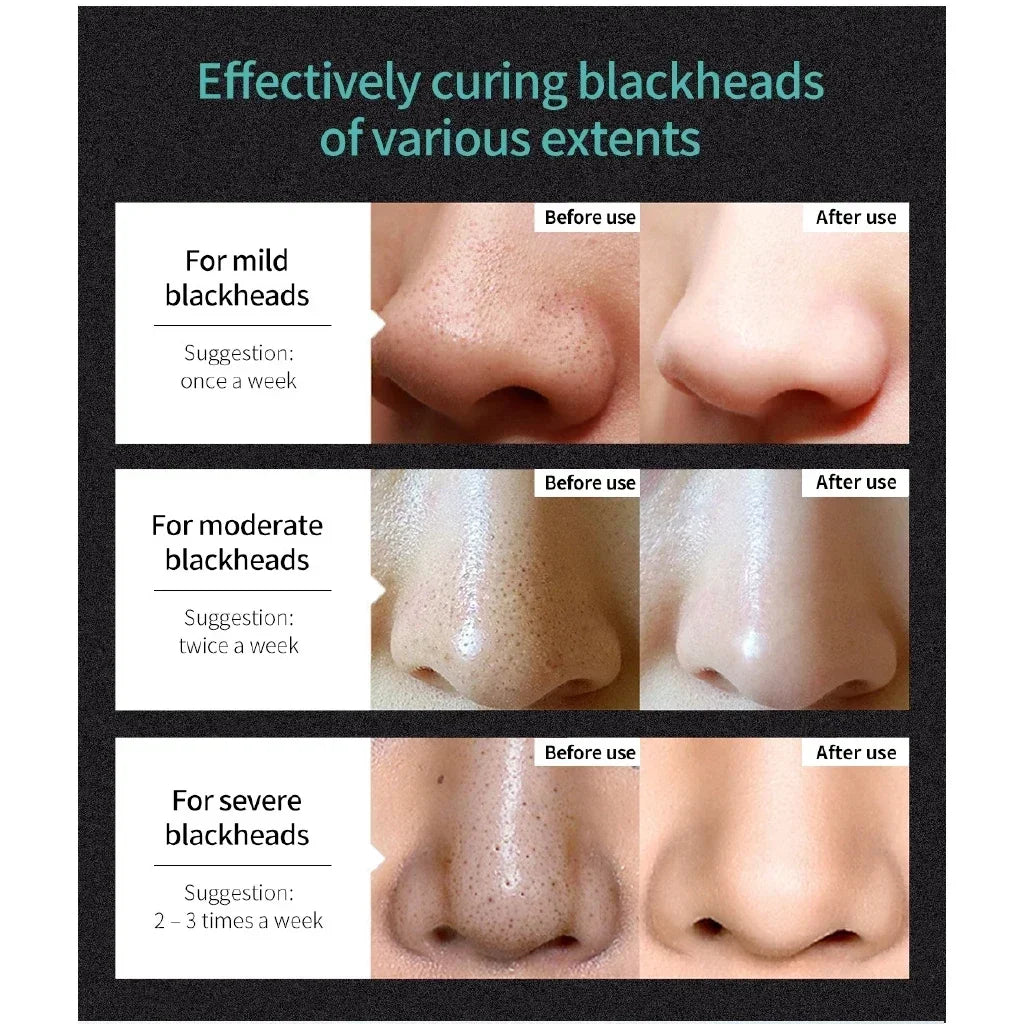 LANBENA Blackhead Remover Nose Black Mask Face Care Mud Peel Off Mask Skin Care 50g