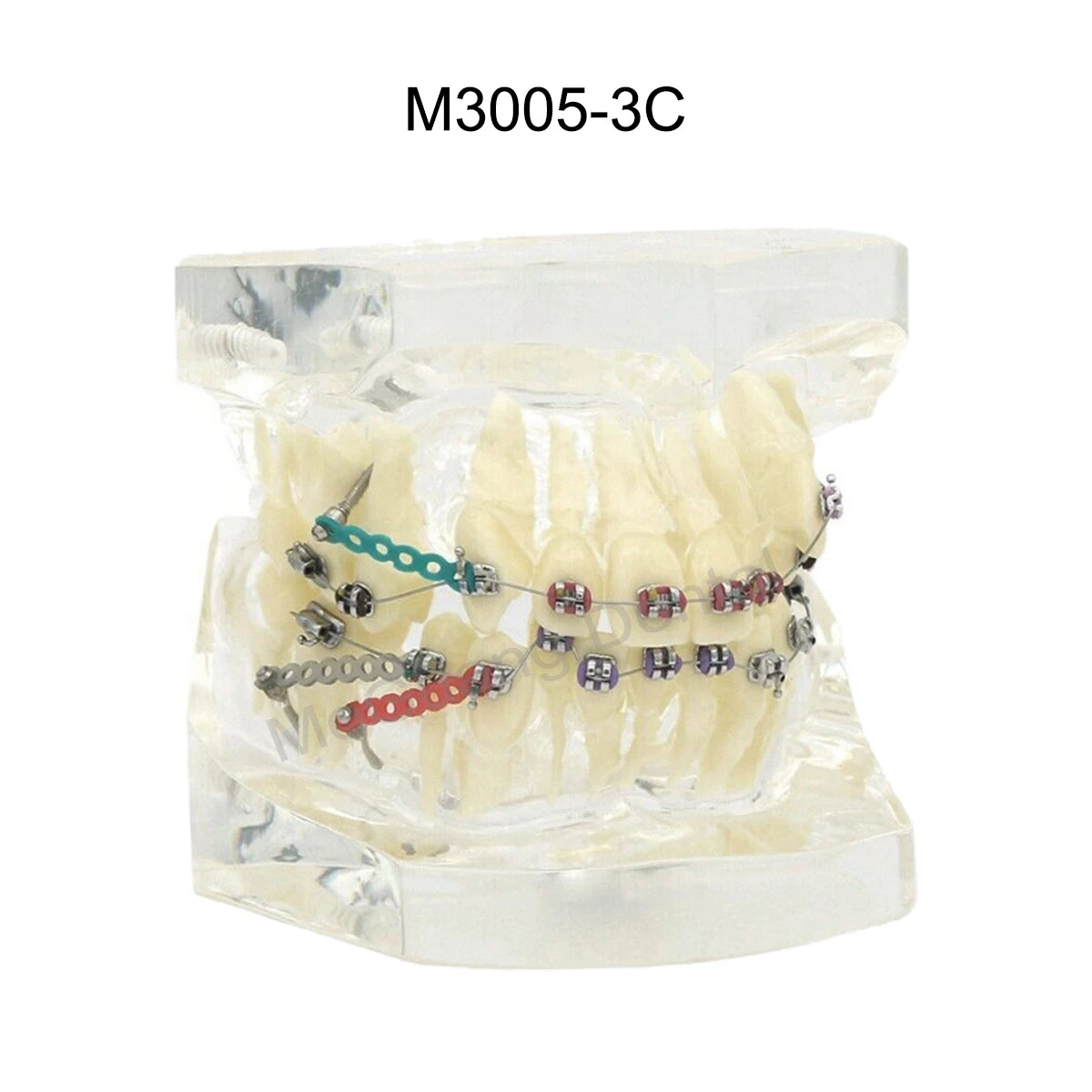 Dental Orthodontic Teaching Models and Cheek Simulator Options
