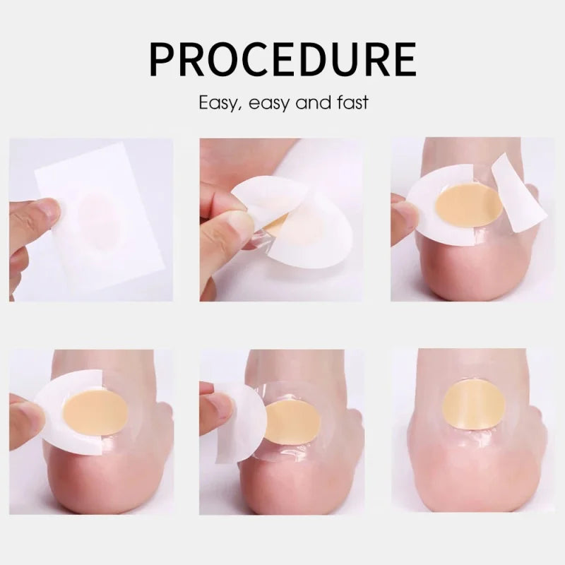 Gél sarokvédő lábfoltok a kényelmes, hólyagmentes lépésekért