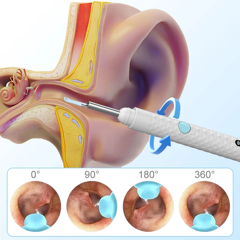 Wireless Visual Otoscope 4.2mm 1080P WiFi Ear Scope with Cleaning Tools