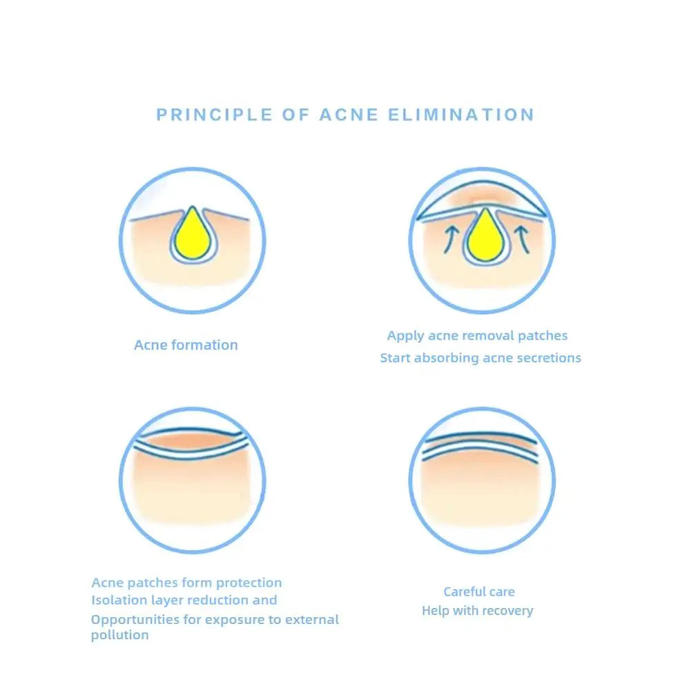 Blue & Yellow Stars Hydrocolloid Acne Patches with Mirror Storage Box