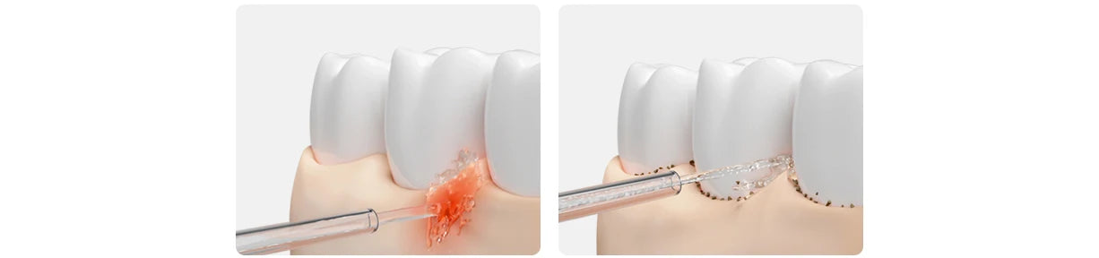 Electric Oral Irrigator with Bubble Pulse Cleaning & 90-Day Battery