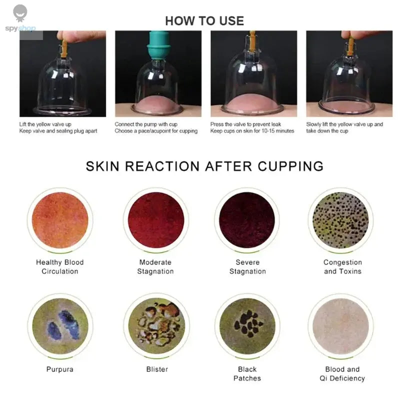 Tuhopeta 6/12/24 Pieces Suction Cups Massage Vacuum Cupping Body Massager Plastic Vacuum Suction Therapy Cupping Set Cans