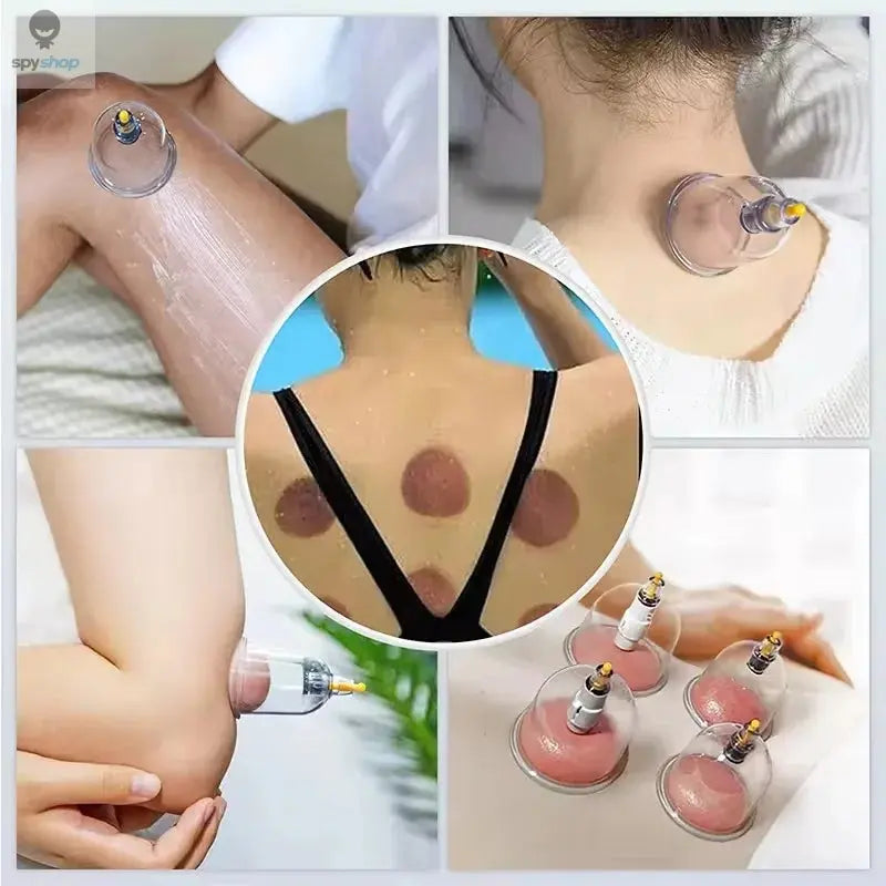Tuhopeta 6/12/24 Pieces Suction Cups Massage Vacuum Cupping Body Massager Plastic Vacuum Suction Therapy Cupping Set Cans