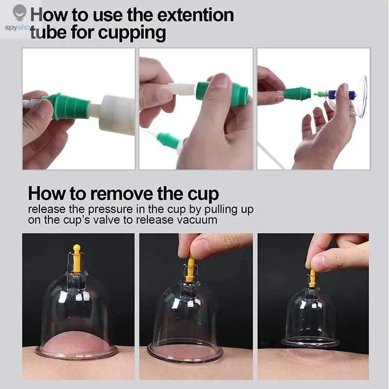 Tuhopeta 6/12/24 Pieces Suction Cups Massage Vacuum Cupping Body Massager Plastic Vacuum Suction Therapy Cupping Set Cans