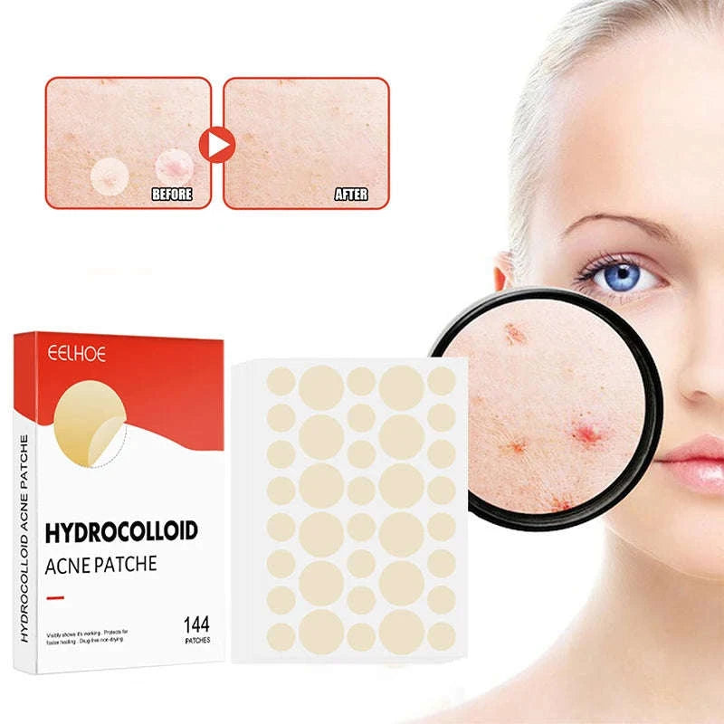 Acne Pimple Patch Set - 144pcs-144pcs