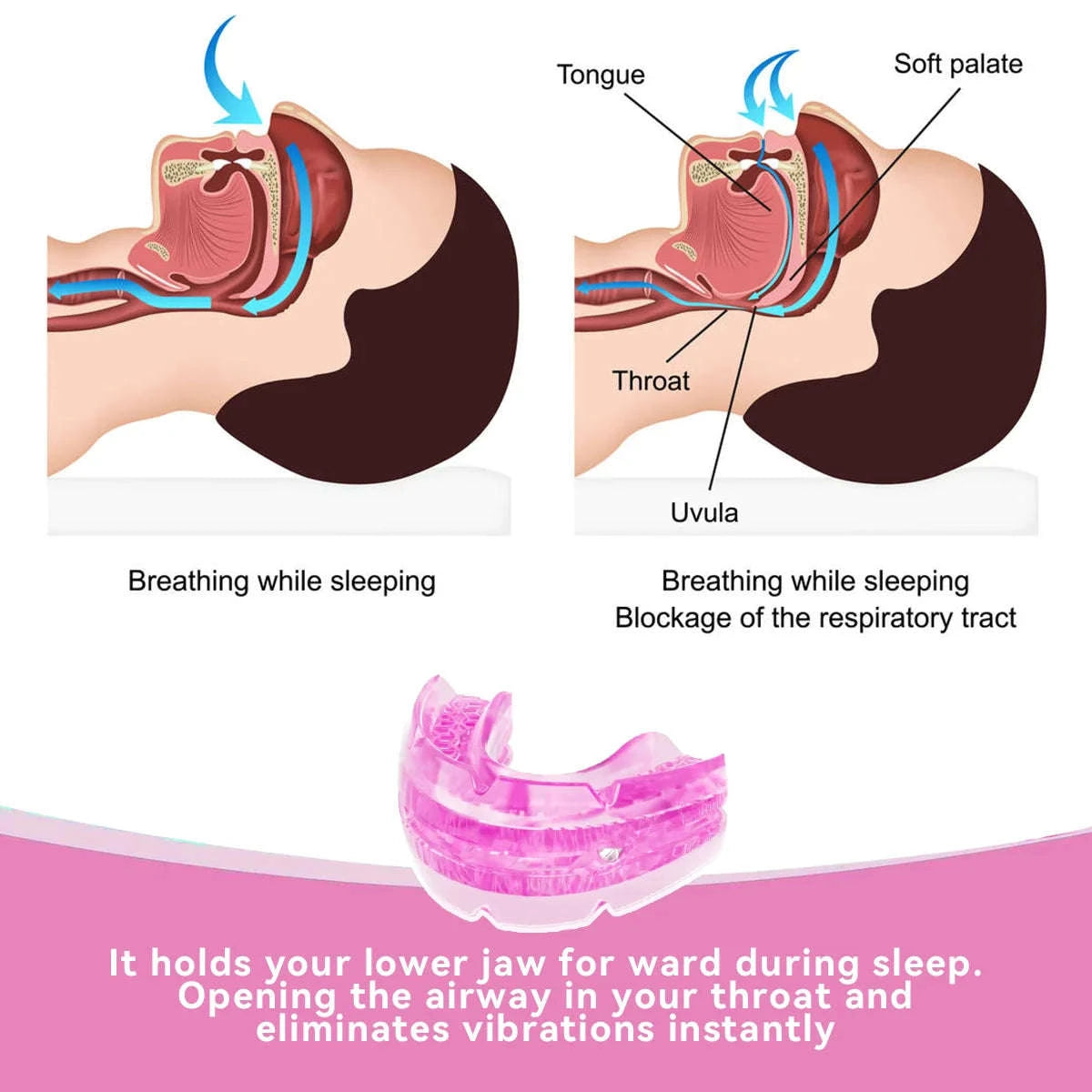 Anti Snore Bruxism Mouth Guard-Pink