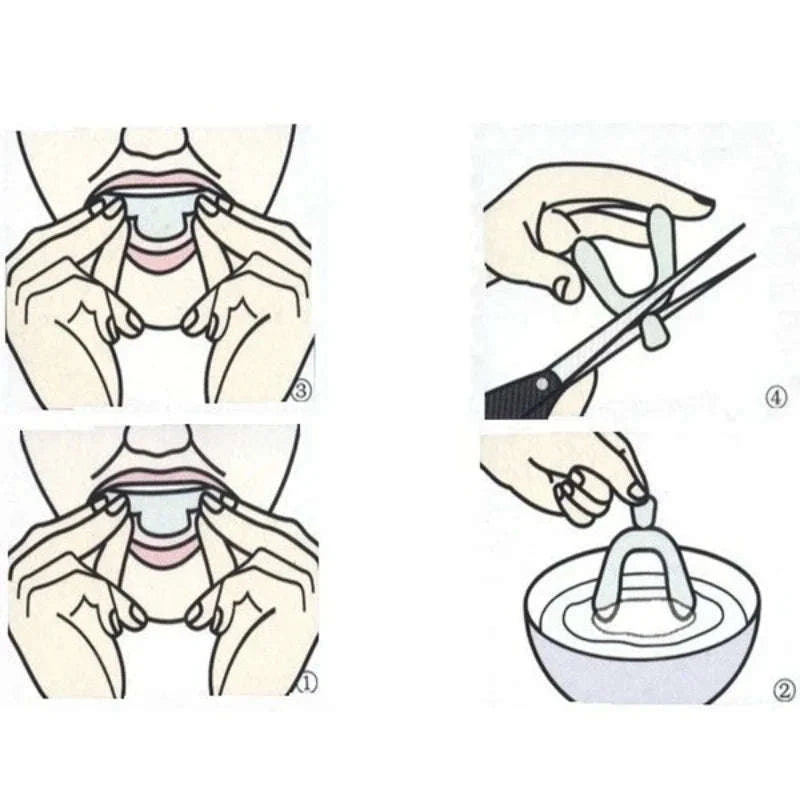 Anti Snoring Mouth Guard for Teeth Grinding Custom Fit Night Guard Set-2 PCS