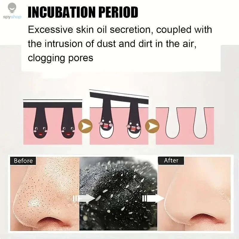 Bamboo Charcoal Blackhead Nose Strips – Deep Pore Cleansing for Clearer Skin-10pcs