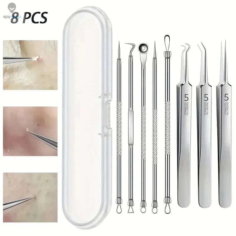 Blackhead Remover Kit – 8-Piece Stainless Steel Acne & Blemish Extraction Set-Silvery 8 pcs