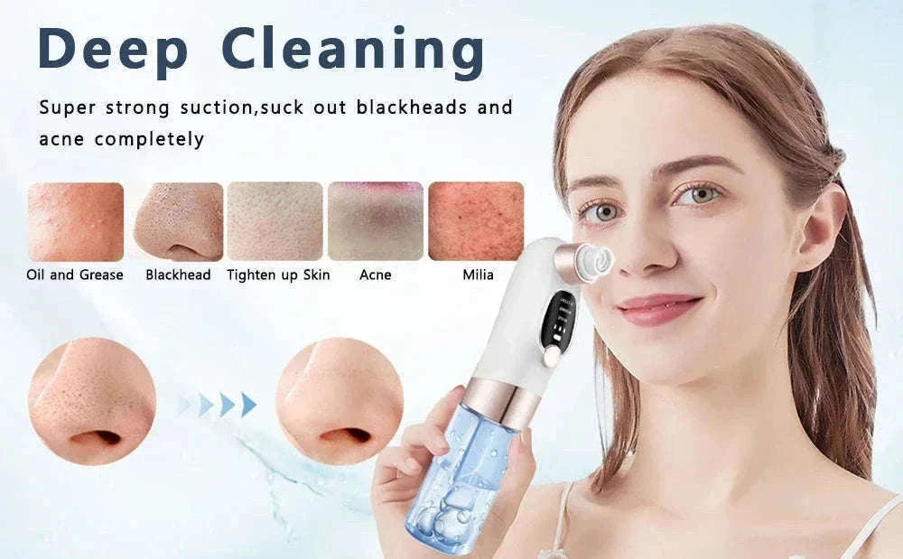 Blackhead Remover Vacuum with Water Cycle & USB Rechargeable-white add gift