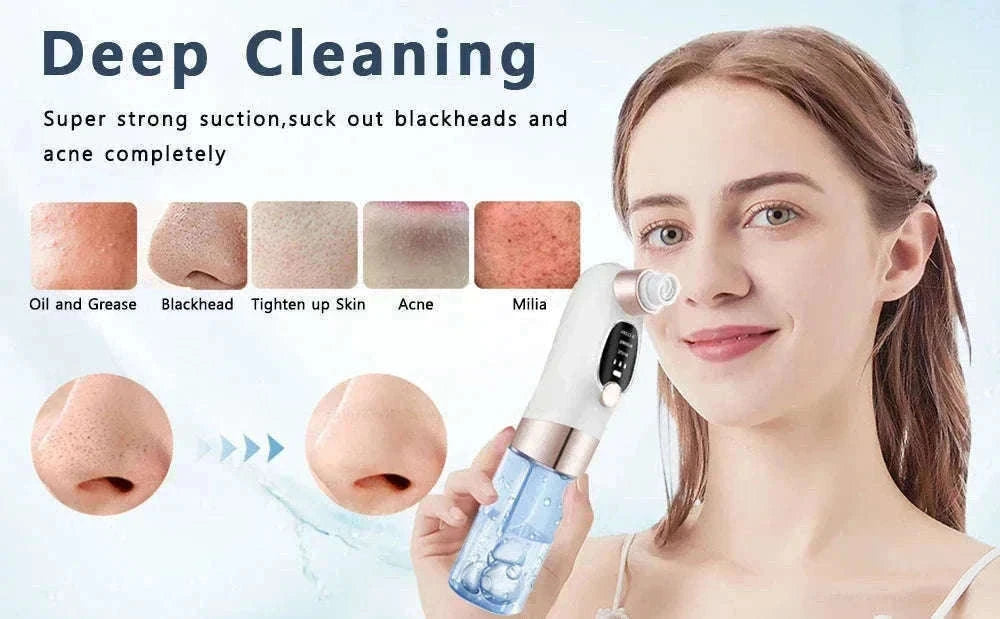 Blackhead Remover Vacuum with Water Cycle & USB Rechargeable-white add gift