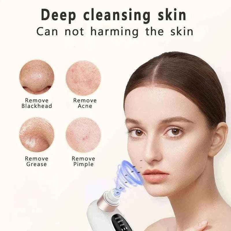Blackhead Remover Vacuum with Water Cycle & USB Rechargeable-white add gift