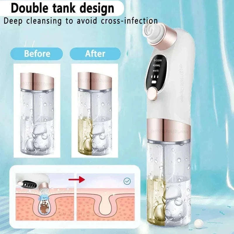 Blackhead Remover Vacuum with Water Cycle & USB Rechargeable-white add gift