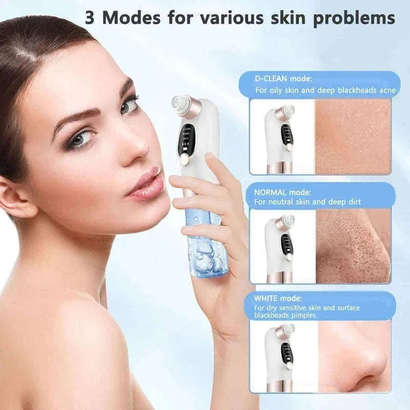 Blackhead Remover Vacuum with Water Cycle & USB Rechargeable-white add gift