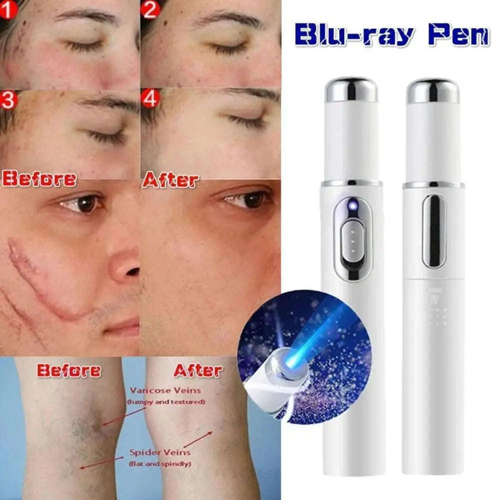 Blue Light Therapy Acne Pen for Clearer, Smoother Skin-1pc