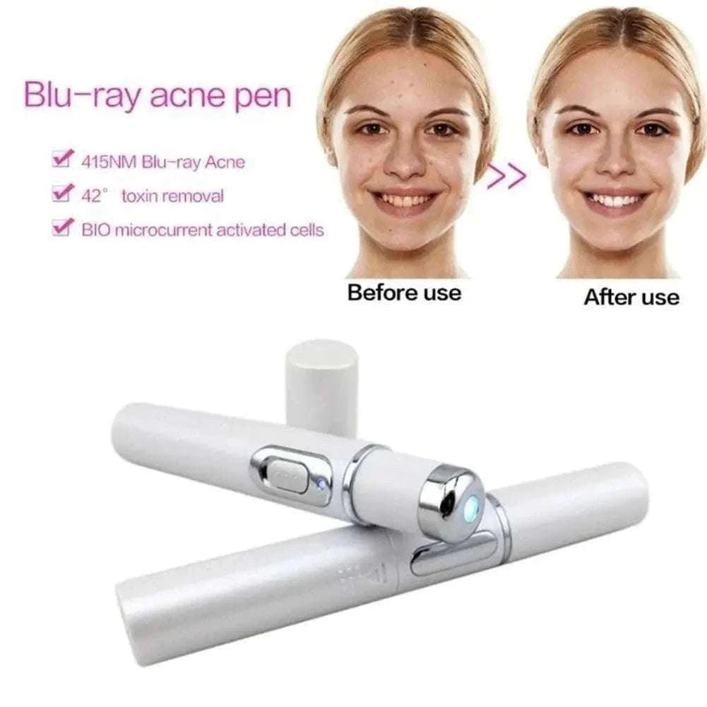 Blue Light Therapy Acne Pen for Targeted Blemish Care-1pc
