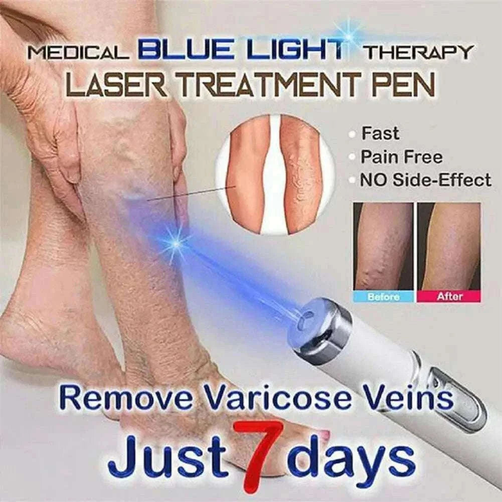 Blue Light Therapy Acne Pen for Targeted Blemish Care-1pc
