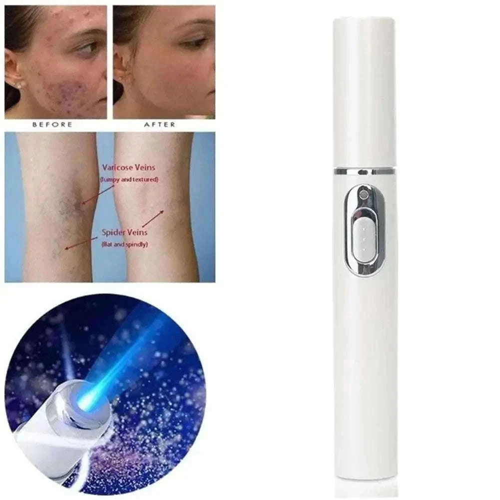 Blue Light Therapy Acne Pen for Targeted Blemish Care-1pc