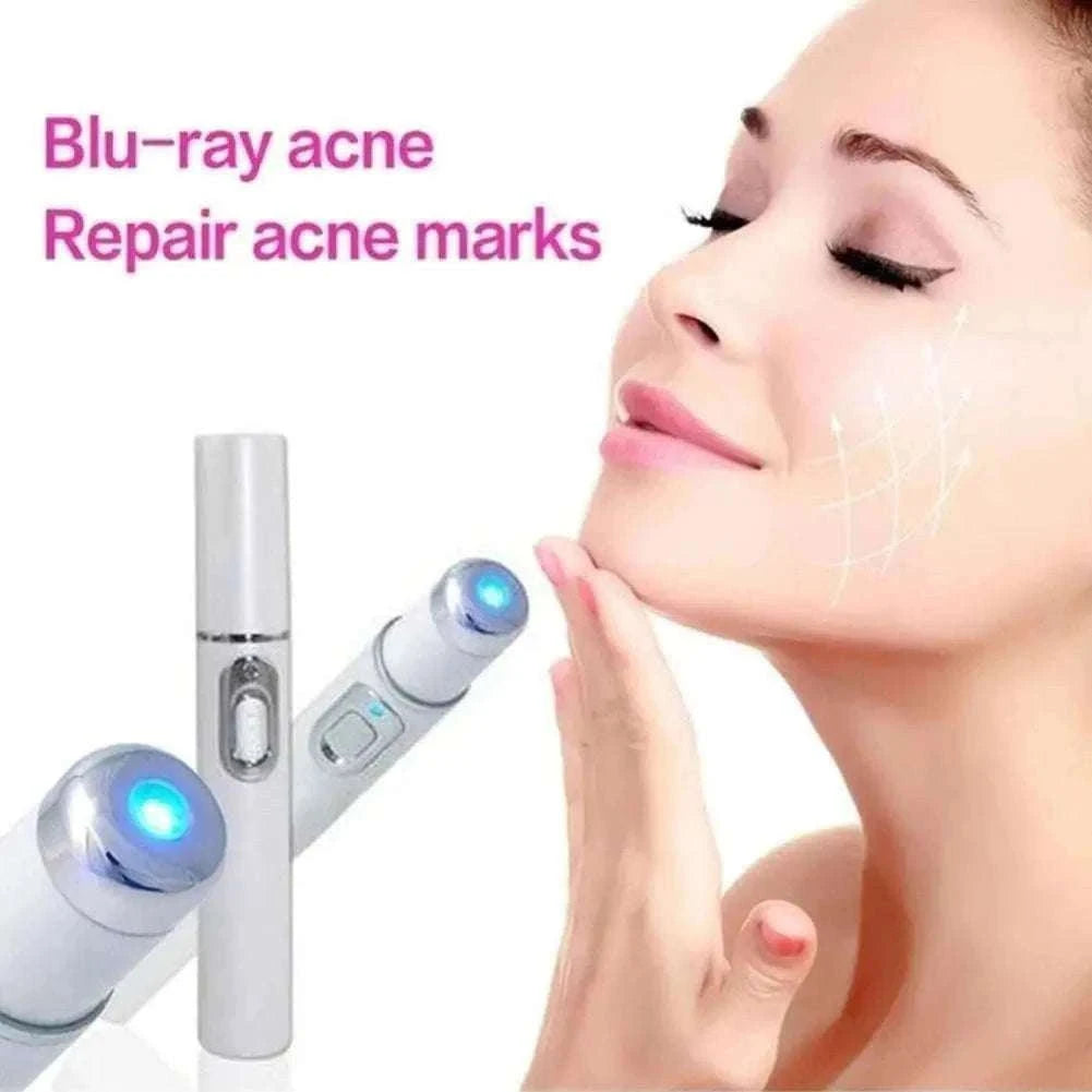 Blue Light Therapy Acne Pen for Targeted Blemish Care-1pc