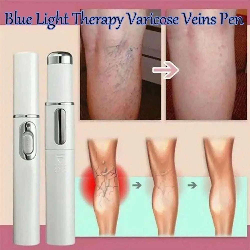 Blue Light Therapy Acne Pen for Targeted Clearer, Smoother Skin-1pc