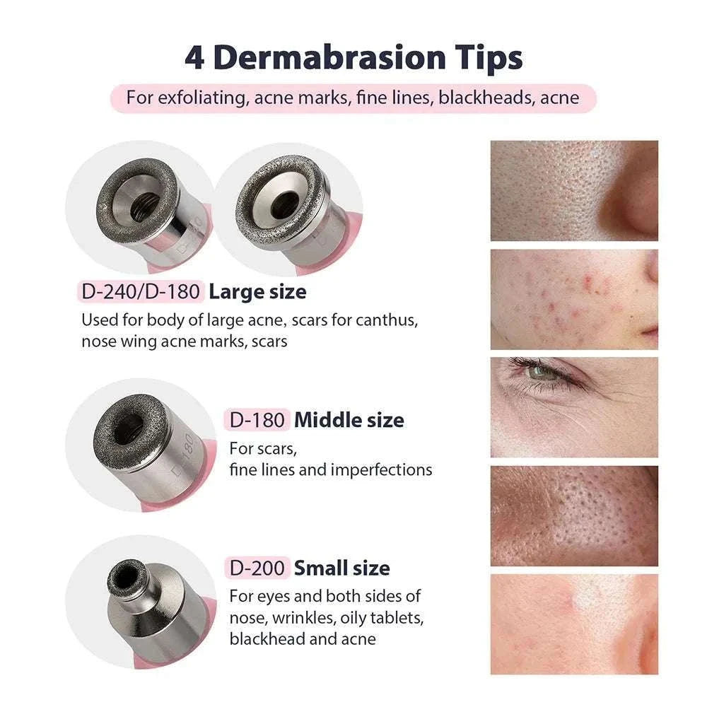 Diamond Microdermabrasion Machine for Deep Facial Exfoliation-US PLUG (100-110V)