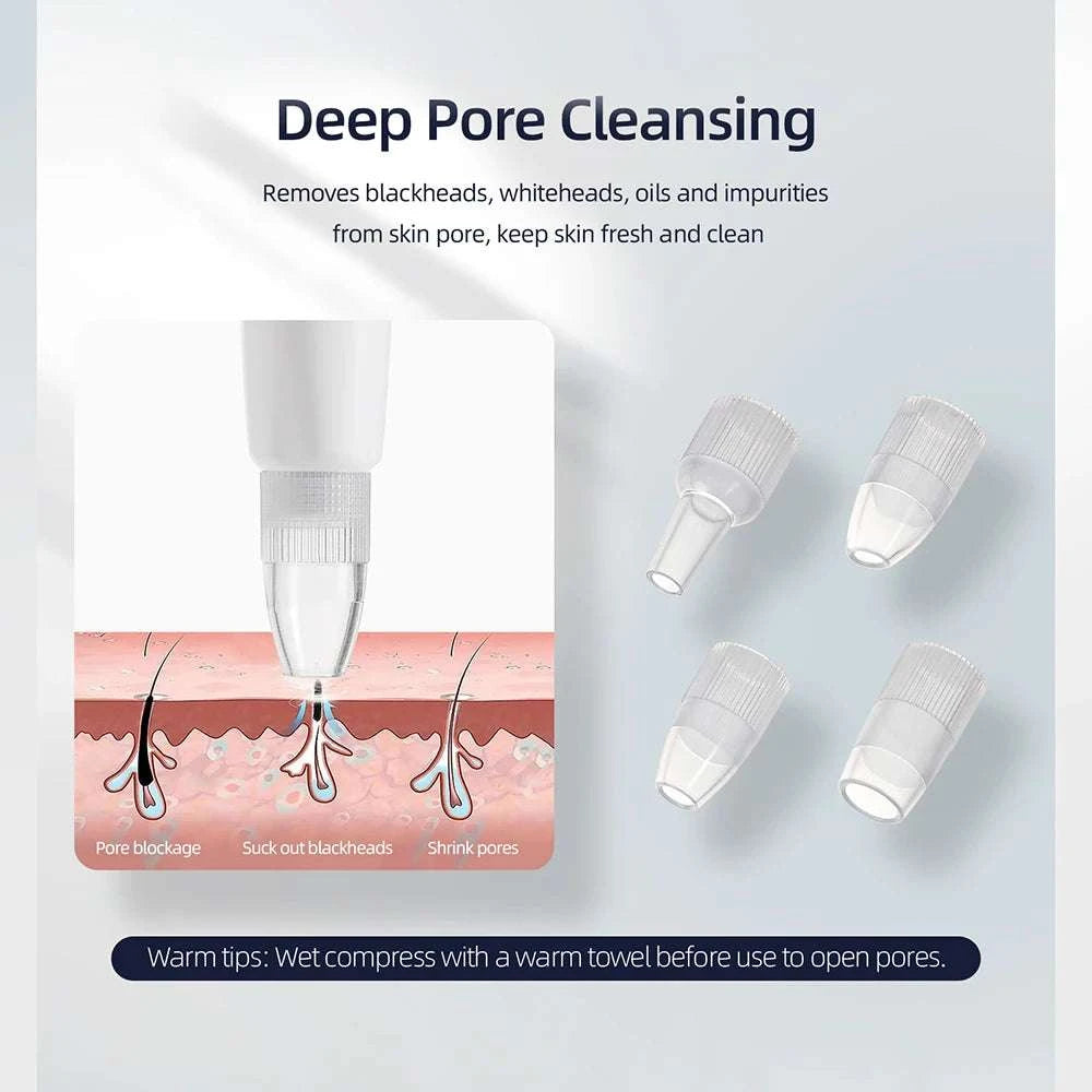 Diamond Microdermabrasion Machine for Deep Facial Exfoliation-US PLUG (100-110V)