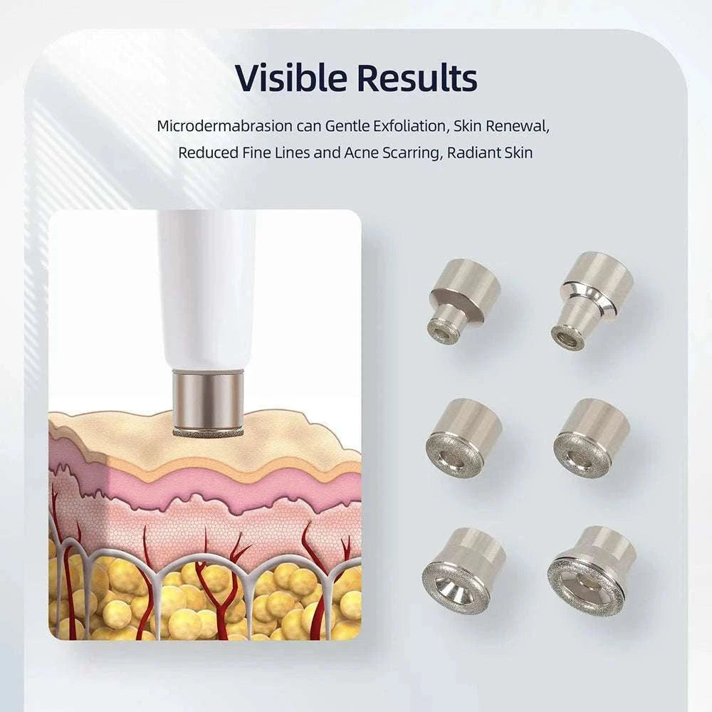 Diamond Microdermabrasion Machine for Deep Facial Exfoliation-US PLUG (100-110V)