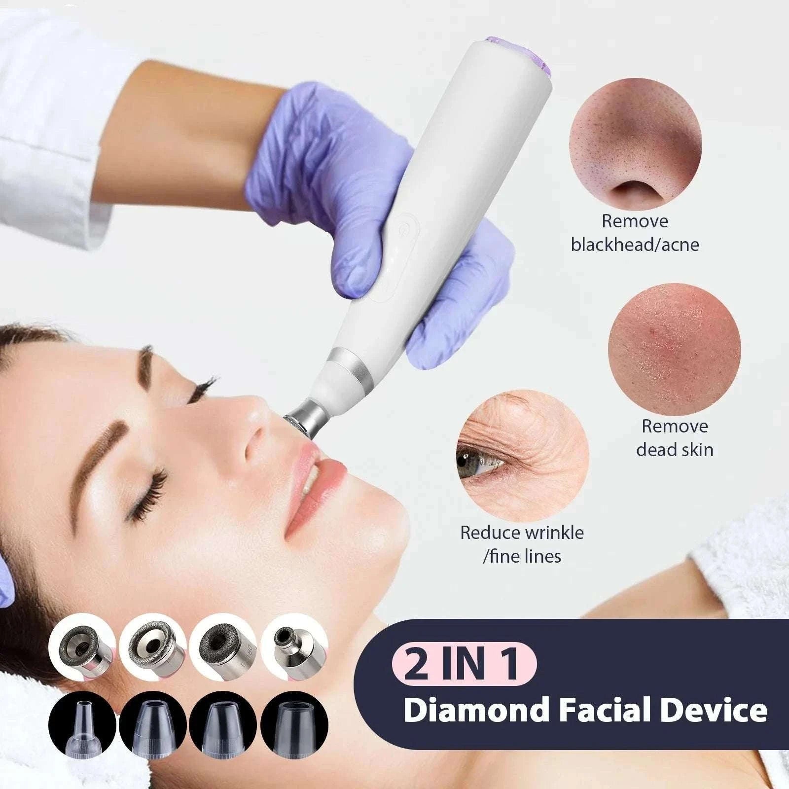 Diamond Microdermabrasion Machine for Deep Facial Exfoliation-US PLUG (100-110V)