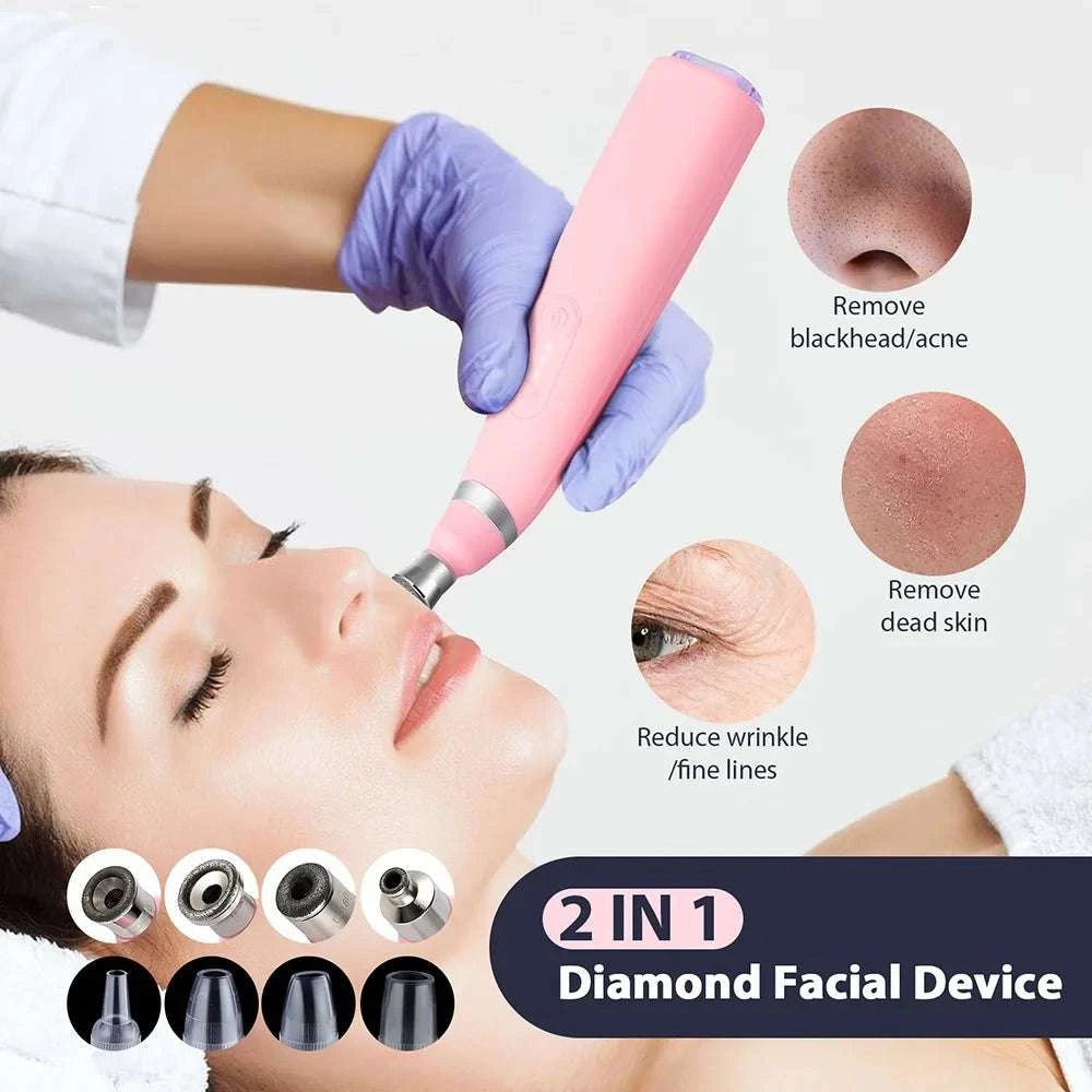 Diamond Microdermabrasion Machine for Deep Facial Exfoliation-US PLUG (100-110V)