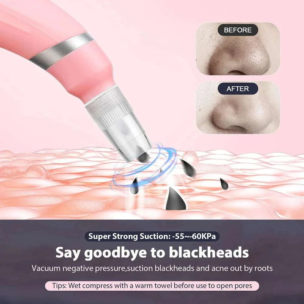 Diamond Microdermabrasion Machine for Deep Facial Exfoliation-US PLUG (100-110V)