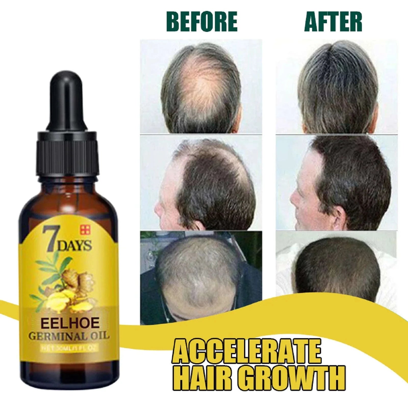 EELHOE 20ml Ginger Hair Growth Oil Strengthening Scalp Nourishing Hair Roots Anti Loss Fuller Care Hairs Essence for Women Men-1 Pc / United States