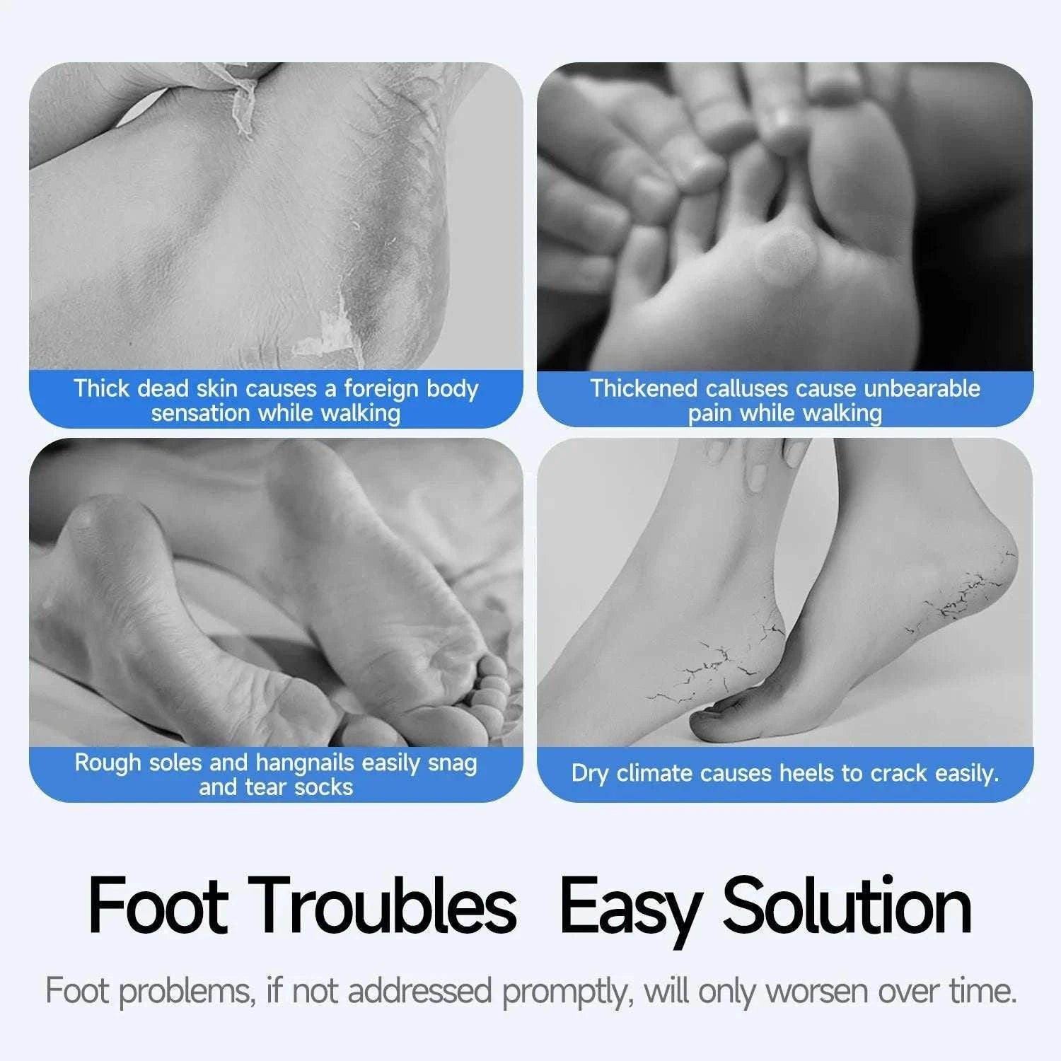 Electric Foot Callus Remover Kit Rechargeable Waterproof Pedicure Tool-
