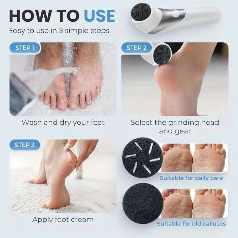 Electric Foot Callus Remover Rechargeable Pedicure Grinder Tool-White 1 / United States