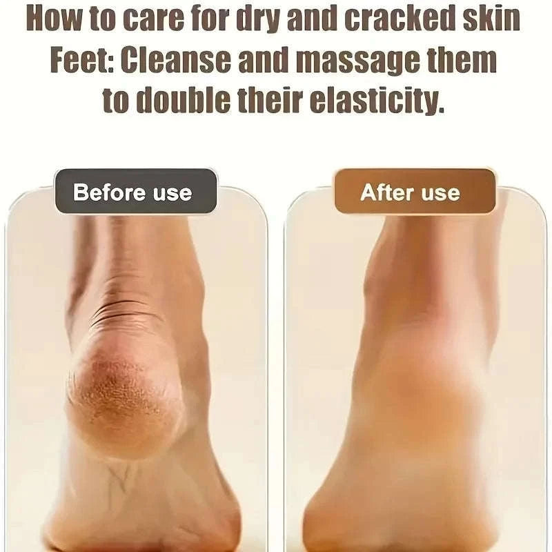 Electric Foot Callus Remover with 3 Roller Heads & 2 Speeds-Upgraded (3 Heads) / United States