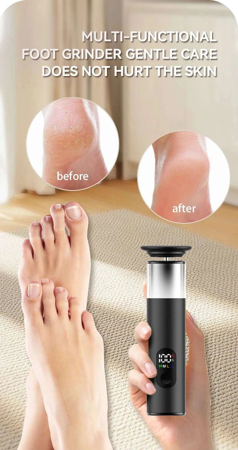 Electric Foot Grinder 2-in-1 Callus Remover & Nail Polisher-Black