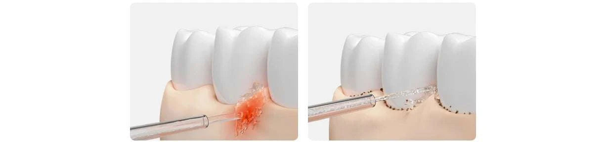 Electric Oral Irrigator with Bubble Pulse Cleaning & 90-Day Battery-Upgraded version