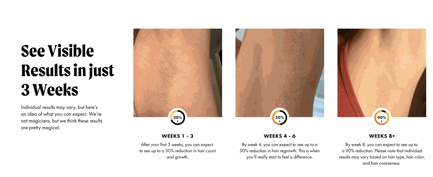 IPL Hair Removal Device with 999,900 Flashes for Full-Body Use-AI01D / US Plug / United States